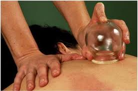 Cupping Benefits